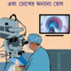 Chhani o Phaco Surgery Ebong Chokher Anyanyo Rog || Dr. Samar Basak